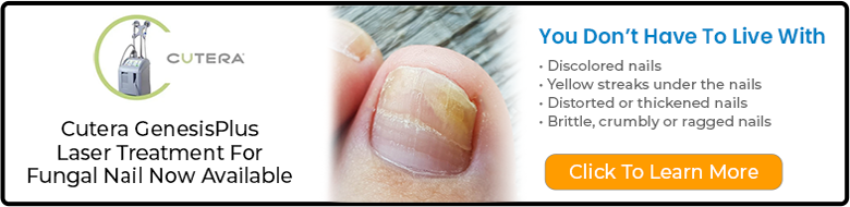 cutera fungal nail banner