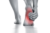Common Causes of Arch Pain